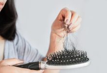 Photo of Cum să evităm căderea părului? Utilizarea topică a produselor