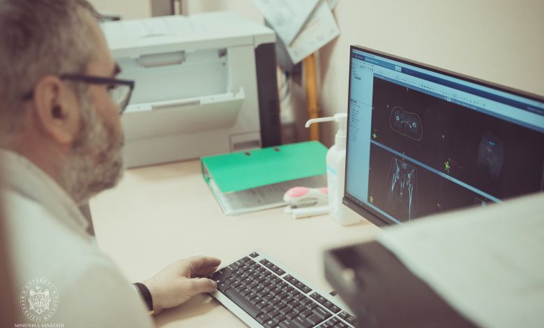 Photo of Institutul Oncologic a fost dotat cu un aparat performant unic în Republica Moldova