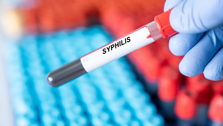 Photo of „Îngrijorări majore” din cauza cazurilor de infectare cu sifilis pe an. OMS trage un semnal de alarmă