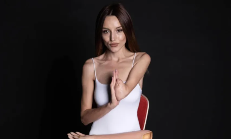 Photo of O tânără care a rămas fără o mână și un picior are nevoie de ajutor