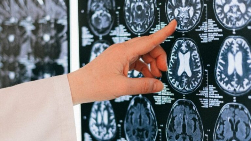 Photo of Oamenii de știință vor analiza 1,6 milioane de scanări ale creierului folosind Inteligența Artificială, pentru a dezvolta un instrument de predicție