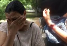 Photo of video | Un copil din Pelinia, atacat de câinele vecinei. Cum se simte minorul