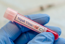 Photo of Autoritățile din R. Moldova monitorizează virusul Nipah, confirmat în India