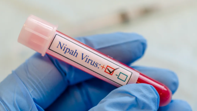 Photo of Autoritățile din R. Moldova monitorizează virusul Nipah, confirmat în India