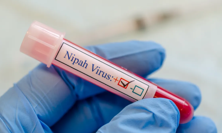 Photo of Autoritățile din R. Moldova monitorizează virusul Nipah, confirmat în India